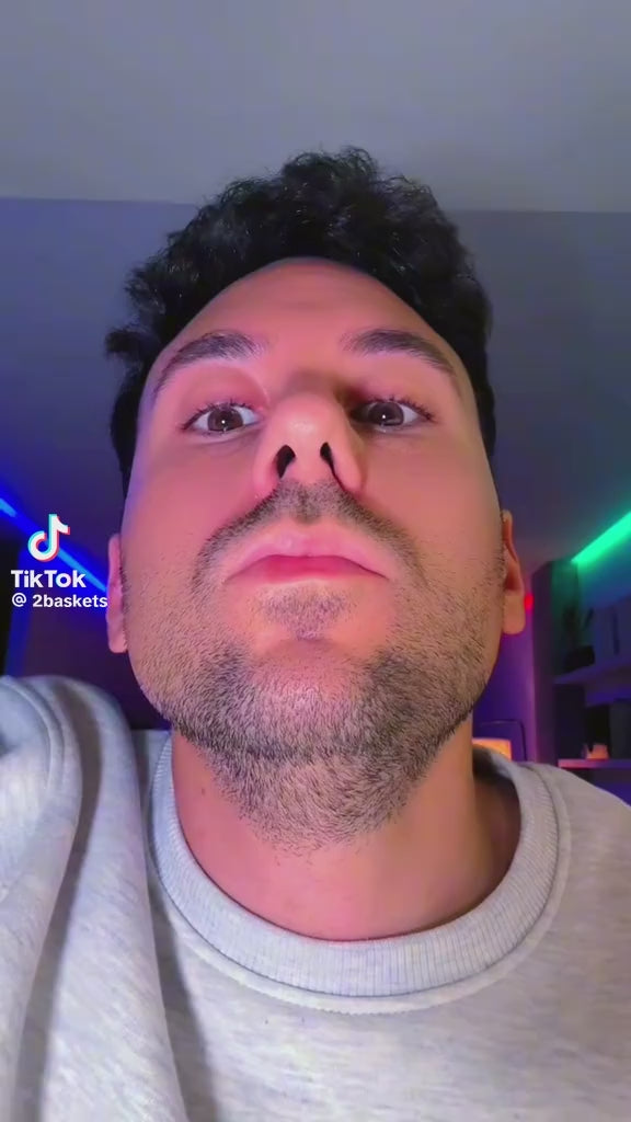 External Nasal dilator